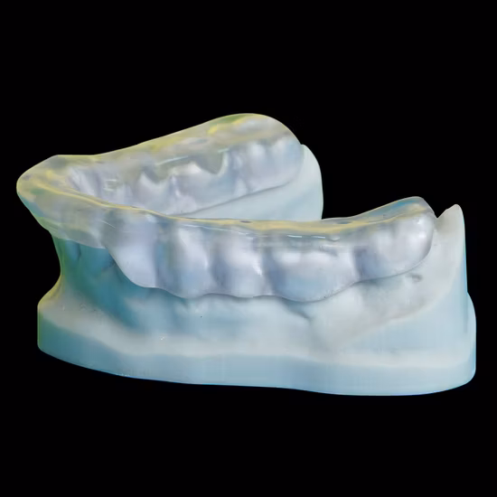 Corone dentali del laboratorio odontoiatrico cinese con protesi Rpd