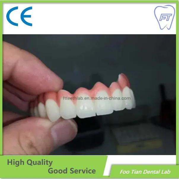 Buon servizio Corona in ceramica metallica dentale realizzata nel laboratorio dentale Foo Tian a Shenzhen in Cina